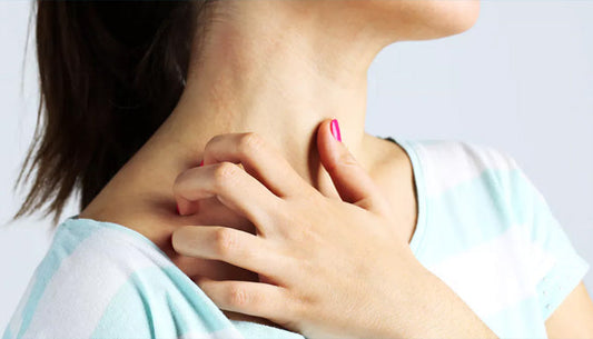 Atopic Eczema - causes and natural solutions Oh Goodness
